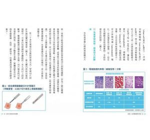 馮思中, 余家政, 林嘉祥 逆癌：泌尿腫瘤最新指南 墨刻